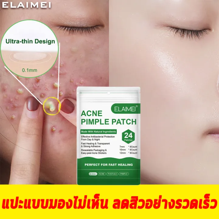 Elaimei แผ่นแปะสิว แผ่นแปะดูดซับสิว ดูดสิวออก ปกปิดสิวรักษาสิว แพคคู่สูตรกลางวันและกลางคืน 0 1mm