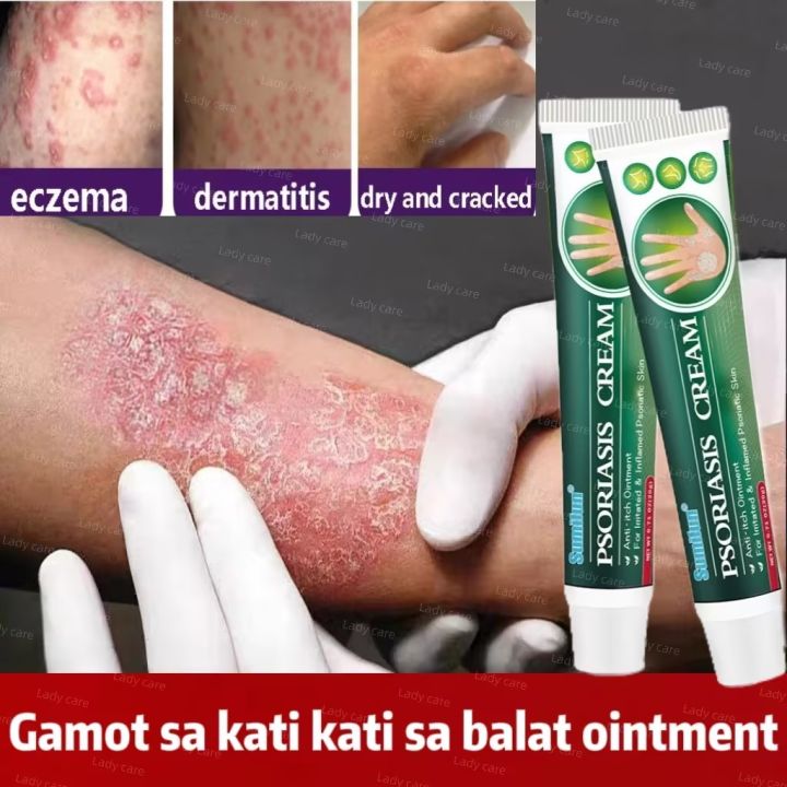 Effective Eczema Cream Original Eczema Psoriasis Remover Ointment Skin Allergy Gamot Sa Kati 4499