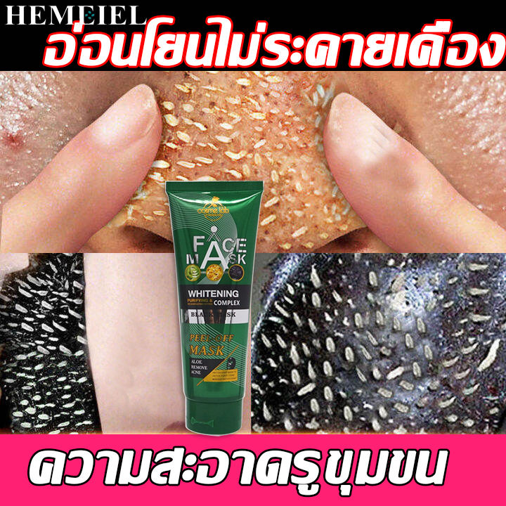 hemeiel-สิวเสี้ยน-ขัดสิวเสี้ยน-แผ่นลอกสิวเสี้ยน-มาร์คหน้าลดสิว