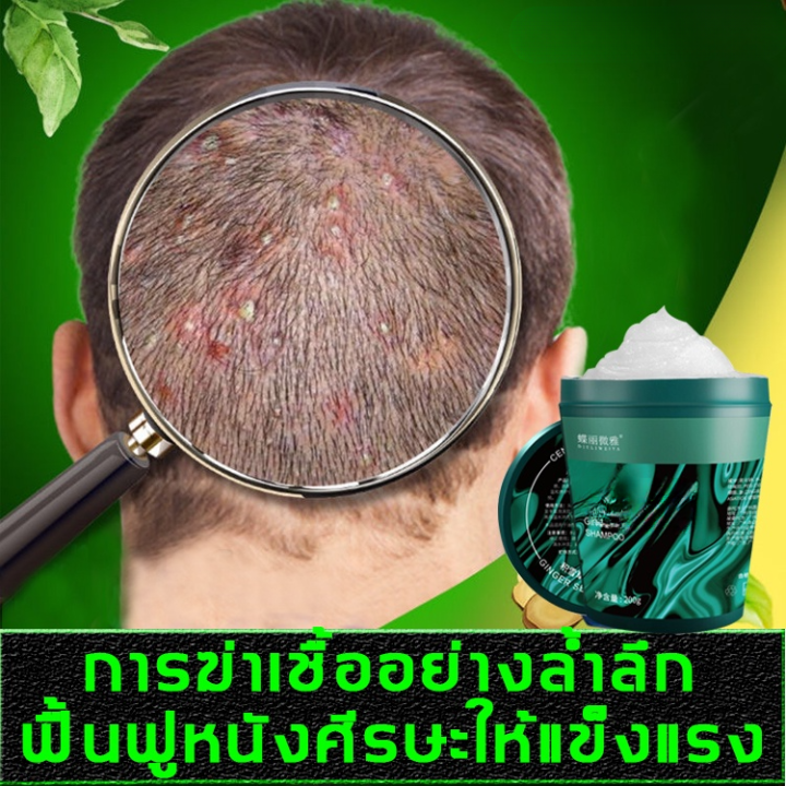 My Image 50