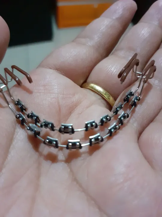retainer like braces black Lazada PH