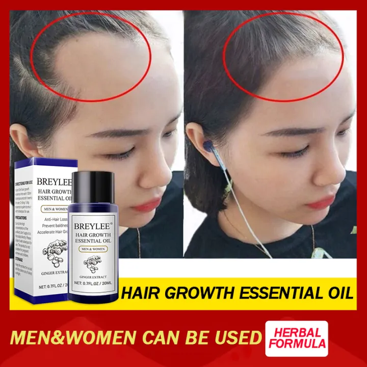 Hair Growth Essential Oil Hair Growth Hair Care Hair Care Essential