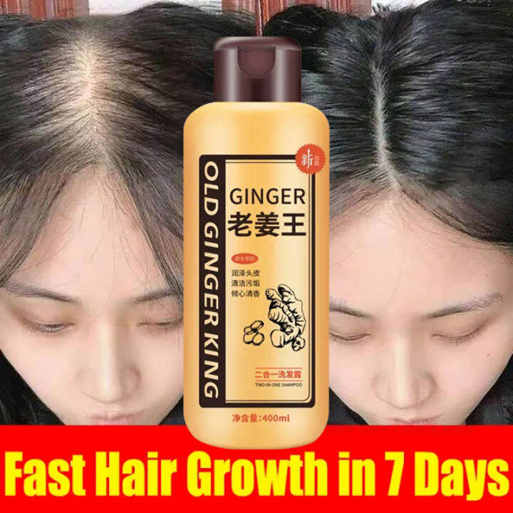 Original Ginger Hair shampoo Anti Hair Loss Nourish Hair Fast Growth ...