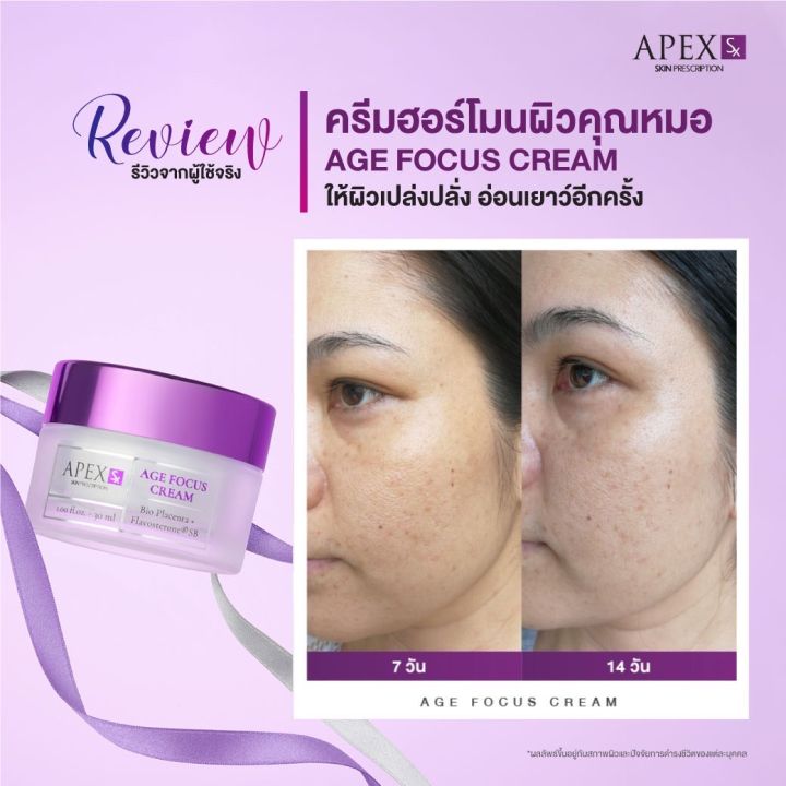 apex-sx-age-focus-cream-ครีมฮอร์โมนผิวสูตรคุณหมอเอเพ็กซ์-ผิวสดใสเปล่งปลั่ง-อ่อนเยาว์อีกครั้ง-30ml