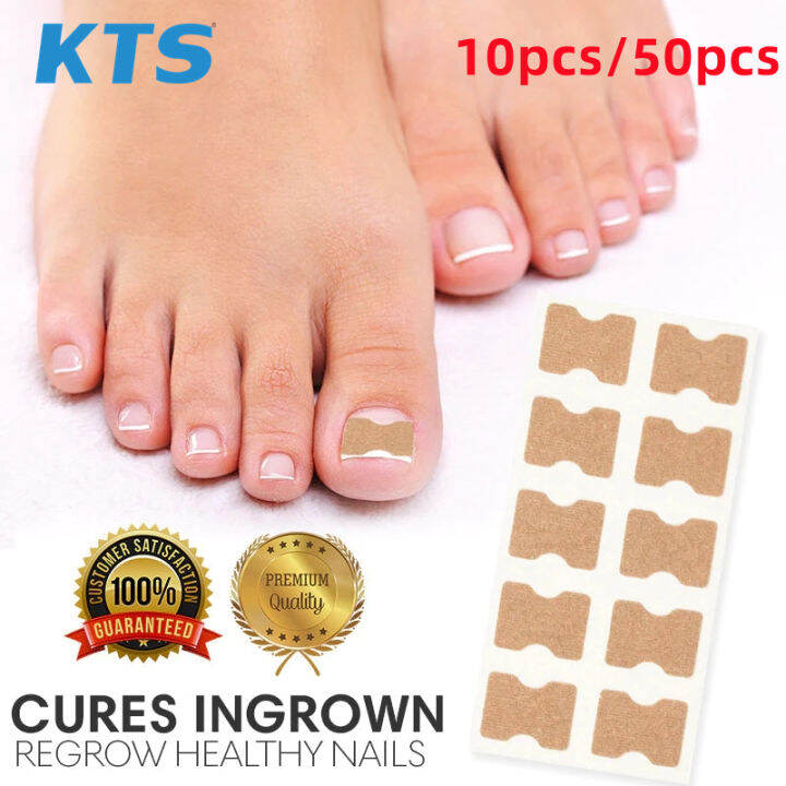 KTS 10/50/100/200pcs Toenail Correction Stickers, Ingrown Toenail