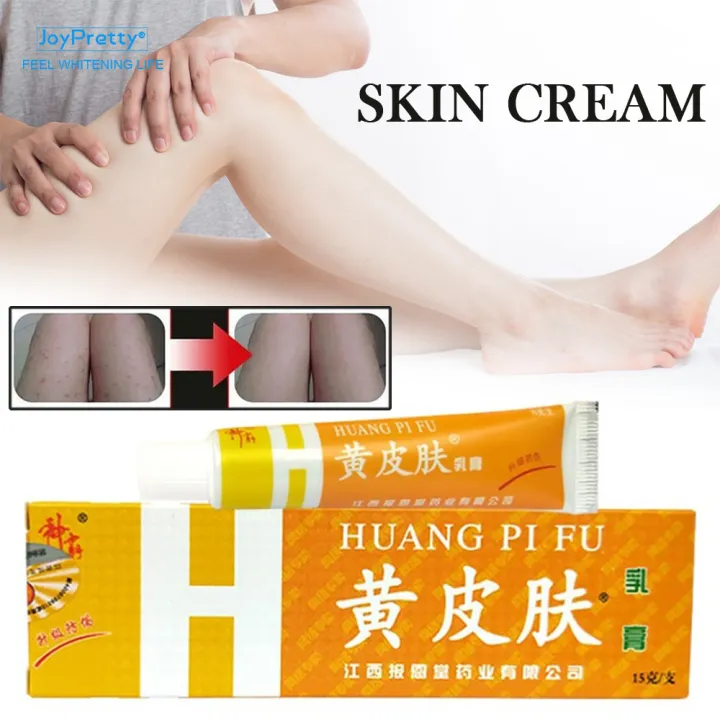 JoyPretty Yellow Skin Anti Itching bacterial Cream Herbal Ingredients