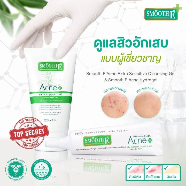 smooth-e-babyface-acne-set-เซ็ตดูแลสิว-จัดการทุกปัญหาสิว-ภายใน-24-ชม