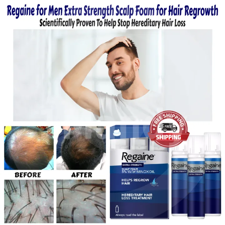 Men's Regaine Foam for Hair Loss and Hair Regrowth, Topical Treatment for  Thinning Hair, 3-Month Supply | Lazada Singapore