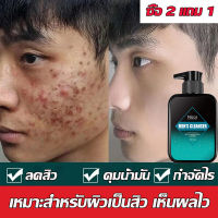 【ซื้อ 2 แถม 1】โฟมล้างหน้าลดสิว โฟมล้างหน้าสำหรับผู้ชาย เนื้ออ่อนโยน โฟมล้างหน้ โฟมล้างหน้าผู้ชาย คุมมัน เพิ่มความชุ่มชื่น หน้าขาวใส