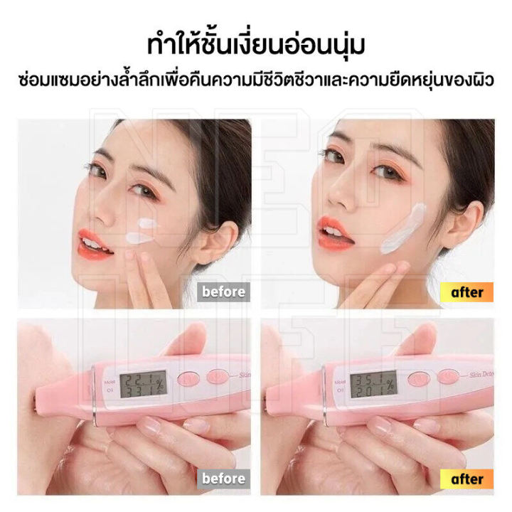 feichunครีมต่อต้านริ้วรอย-เปปไทด์-ครีมทาหน้า-ต่อต้านริ้วรอย-aliver-ครีมกลางคืนและกลางวัน-ลดเลือนริ้วรอย-จุดด่างดำ-บำรุงผิวหน้า-กระชับผิว-ซ