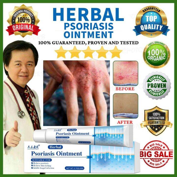 Antibacterial Cream Psoriasis Cream Eczema Cream Relief Skin Rash ...