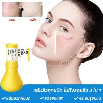 เซรั่มลดริ้วรอยลดสิว ราคาถูก ซื้อออนไลน์ที่ - ก.ย. 2023 | Lazada.Co.Th