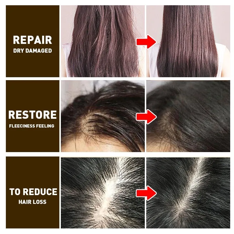 Shampoo ng kabayo and conditioner Hair Grower anti dandruff Oil control