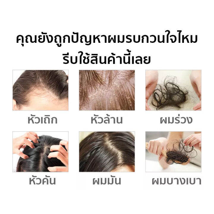 ของแท้-100-zenshow-แชมพูเร่งผมยาว-แชมพูแก้ผมร่วง-แชมพูขิงเพียว-แชมพูลดผมร่วง-ยาสระผมแก้ร่วง-แชมพูขิงของแท้-hair-loss-shampoo-ยาสระผมเร่งยาว-สูตรน้ำขิง-ปลูกผมอย่างอ่อนโยน-บำรุงรากผม-ปลูกผม-เร่งผมเกิดให