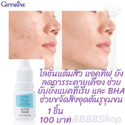 #โลชั่นแต้มสิว แอคทีฟ ยัง กิฟฟารีน GIFFARINE ACTIVE YOUNG ACNE LOTION #โลชั่นบรรเทาอาการอักเสบของสิว #รหัสสินค้า 22101