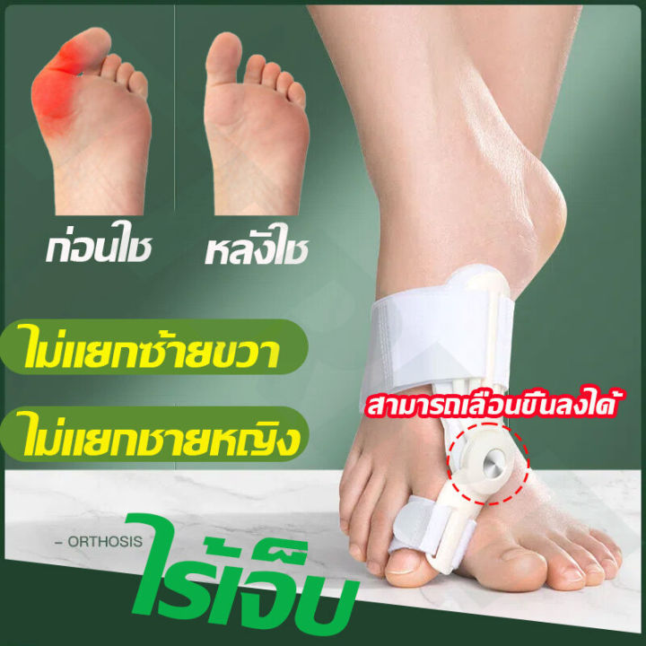 นำเข้าจากประเทศเยอรมนี-อุปกรณ์ดัดนิ้วเท้า-อุปกรณ์แก้ไขเท้าผิดรูป-ซิลิโคนคั่นนิ้วเท้า-อุปกรณ์คั่นนิ้วเท้า-อุปกรณ์แก้ไขเท้า-นิ้วโป้งโค้งงอเข้