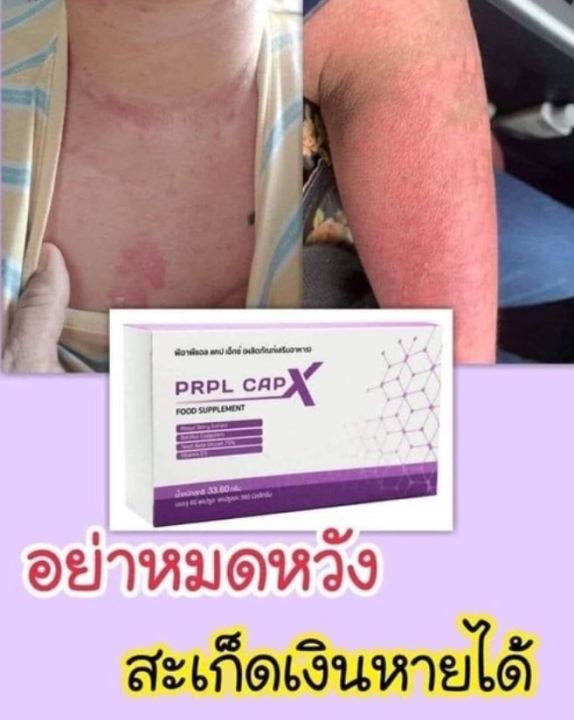 prpl-capx-ซ่อมแซม-ป้องกัน-โรคต่างๆ-1-กล่อง-60-แคปซูล-ของแท้