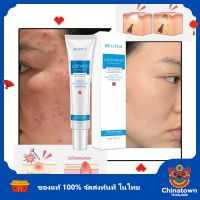 ครีมลดสิว ของแท้100% พร้อมส่งจากไทย 30g สำหรับผิวที่เป็น สิว สิวผด ลดเลือนรอยสิว ครีมกำจัดสิว