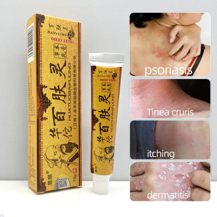 HUATUOBAIFULING 华佗百肤灵 止痒膏 Natural Chinese Herbal Medicine Cream Eczema ...