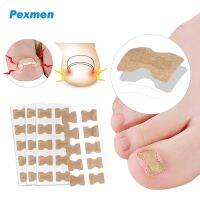 【CW】△✼  Pexmen 10/20/50/100Pcs Ingrown Toenail Correction Stickers Corrector Big Toe for Men