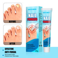 Nail Fungus Removal Cream Nail Care Ointment Anti-Infection สำหรับเล็บเท้า Antibacterial Infection Repair Ointment Feet Care 20G