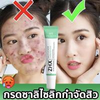 ?ZHENXIU ครีมรักษาสิว ครีมแต้มสิว ครีมลดสิว ทำให้ใบหน้าสะอาดและขาวใส? 20g【COD】