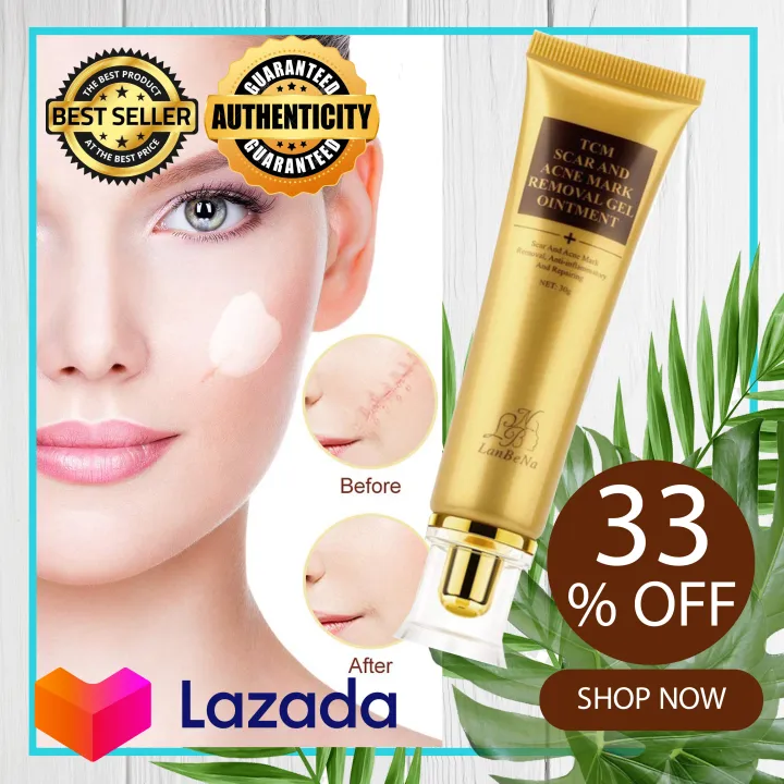 Scar and Acne Mark Pimple Marks Scars Removal Gel Ointment 30g Lazada PH