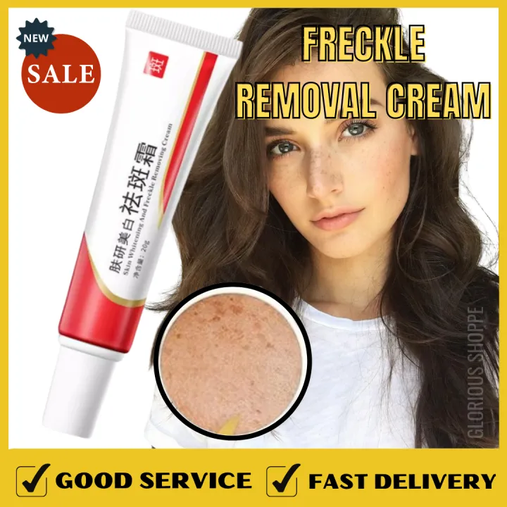 NEW ARRIVAL Skin Whitening and Freckle Removing Cream Whitening,Freckle ...