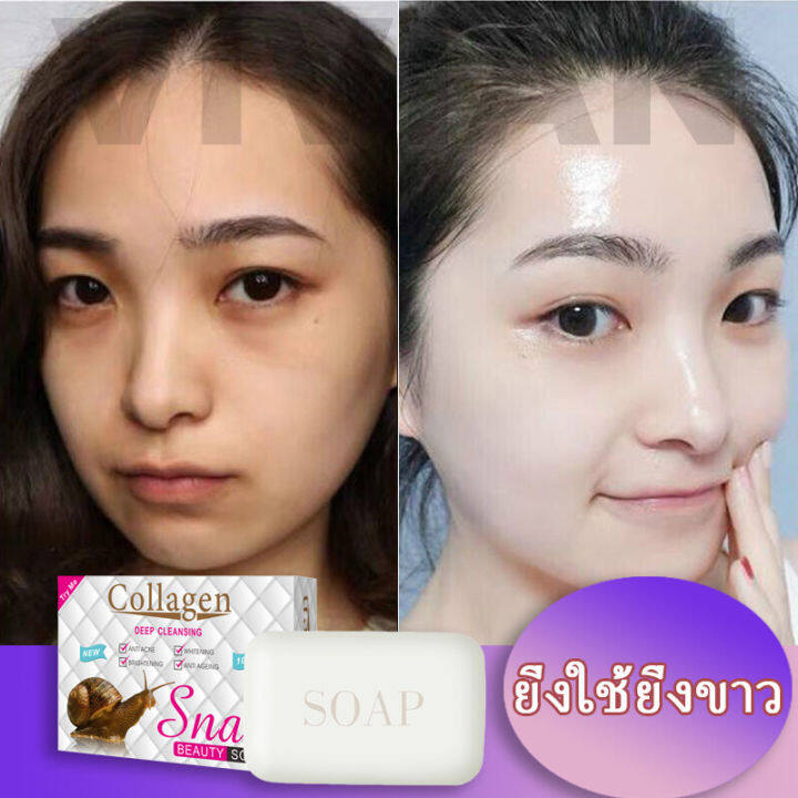 peimei-สบู่ล้างหน้า100g-สบู่หอยทาก-สบู่ล้างหน้า-สบู่ผิวขาว-สบู่-สบู่สูตรลับ-ครีมทาผิวขาว-ถาวรสบู่เร่งผิวขาว-สบู่สูตรเฉพาะ-สบู่หน้าขาวใส-เร่งผิวขาวกระจ่าง-โฟมล้างหน้า-ครีม-ครีมทาผิว-สบู่แฮนด์เมด-สบู่มอ