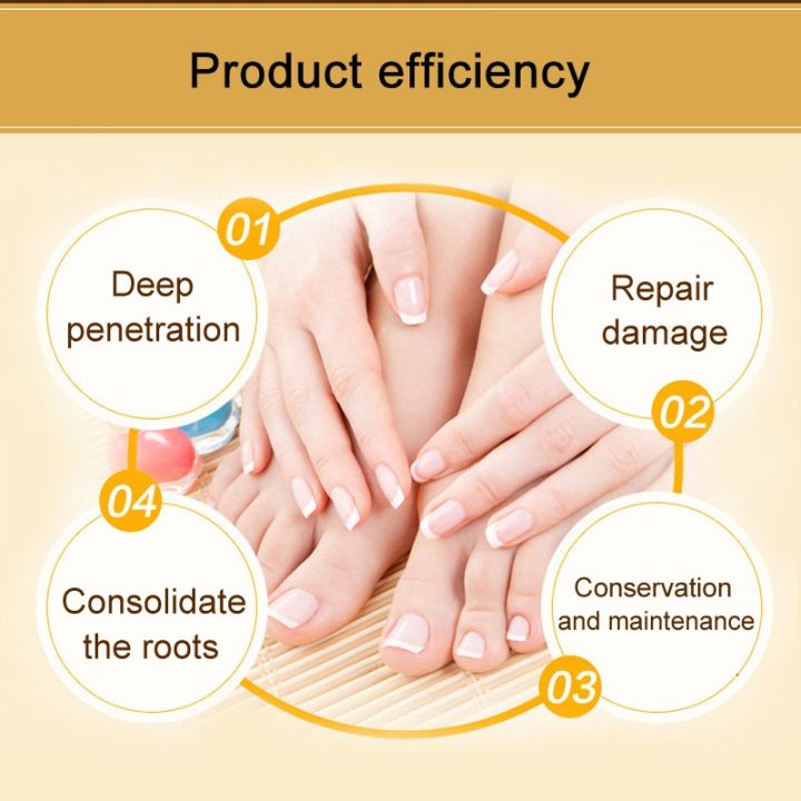 new-30ml-fungal-nail-treatment-nail-care-essence-anti-fungus-toe-nail-finger-infection-repair-liquid-sci88