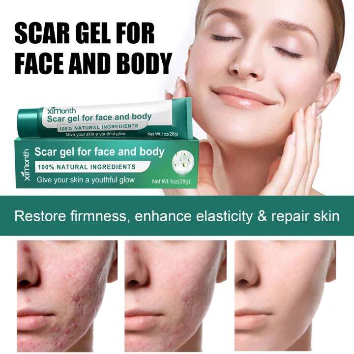 Scar Cream Gel Advanced Silicone Scar Gel Professional Scar Away Removal Cream For Surgical 5762