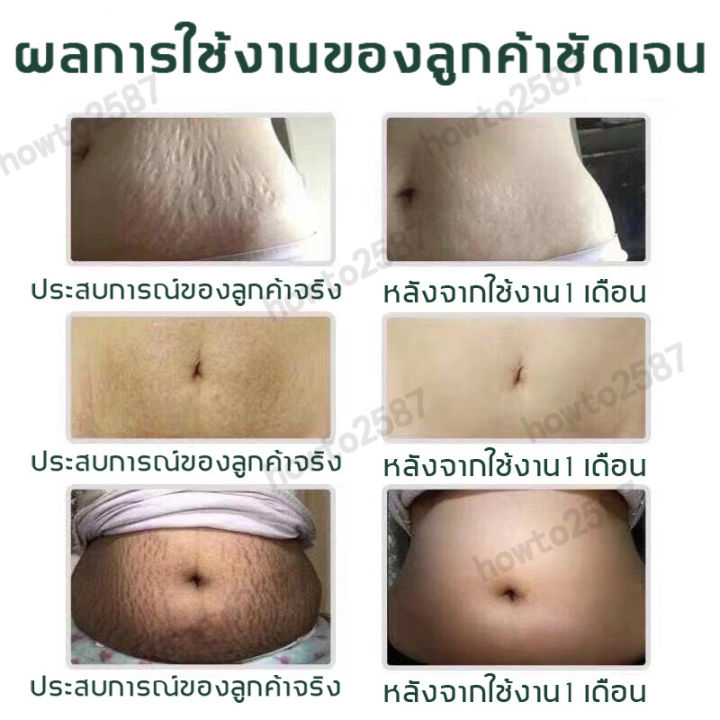 ข้อเสนอจำกัดเวลา-aichun-100ml-ครีมรอยแตกลาย-ครีมบำรุง-ยกกระชับฟื้นฟูและชุ่มชื้น-ครีมทาท้องแตกลาย-ครีมทาแตกลาย-ครีมลบรอยแตก-ครีมทาท้องลาย-ครีมลบรอยแตกลาย-ยาทาแก้ขาลาย-ครีมแก้ท้องลาย-ครีมลดรอยแตกลาย-ครี