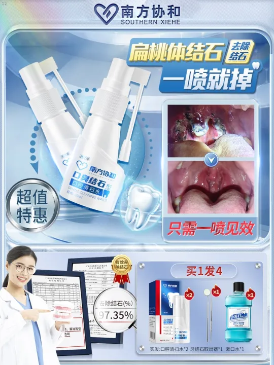 Tonsil Stones Removal Tool To Remove Artifact Mouthwash Attractor