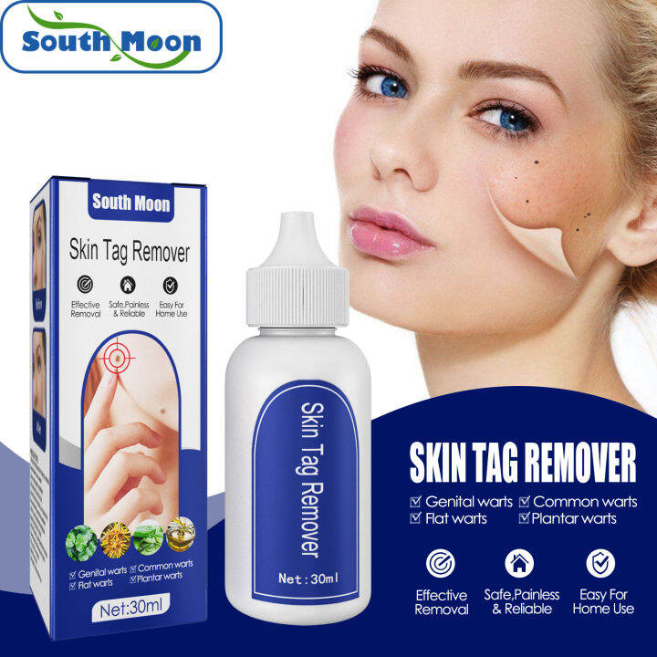 South Moon Mole Remover Liquid Tags Remover Warts Effective Skin Tags 