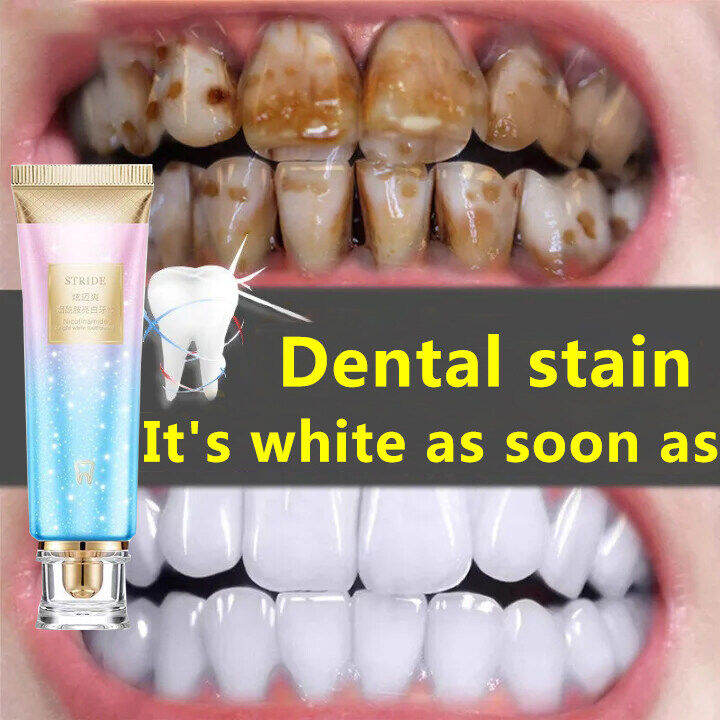 Whitening Toothpaste Tooth Whitening Toothpaste Activated Charcoal