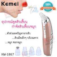 Blackhead Cleaning Beauty Tools Kemei KM-1867 อุปกรณ์ดูดสิวเสี้ยน กำจัดสิวเสี้ยนจมูก ดูดสิวที่ค้าง ดูดสิวที่จมูก ดูดออกง่าย ปรับความแรงได้ 3 ระดับ จับถนัด