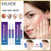 EELHOE Skin Tags Pen Skin Tag Mole Wart Remover Foot Corn Removal Of Warts Liquid Warts Remover Pen Skin spot Tag Remover Blemish Removal Antibacterial