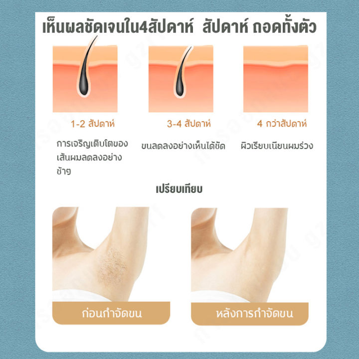 bkkgo-กำจัดขนที่บ้านสำหรับผู้หญิงและผู้ชาย-อัพเกรดเป็น-999-999-กะพริบเลเซอร์กำจัดขนถาวร-อุปกรณ์กำจัดขนถาวรสำหรับใบหน้าทั่วร่างกาย