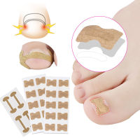 คุด Toenail Corrector สติกเกอร์เล็บ Strip Anti-ม้วนเล็บฟรีกาว Toe Inlay Nail Corrector Patch Correction สติกเกอร์ Toenail-Aluere