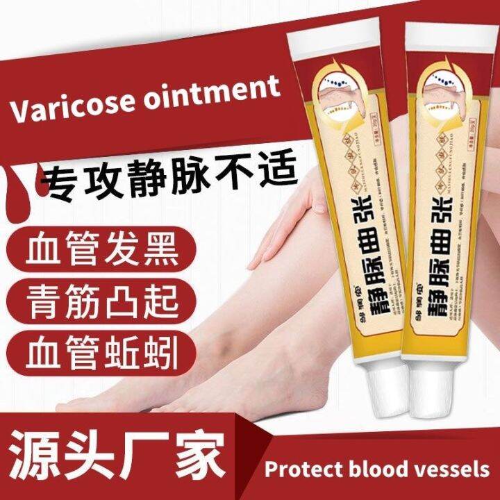 Herbal Varicose Veins Treatment Cream Cold Compress Gel Body Skin Care
