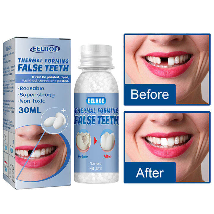 Letat🔥 Falseteeth Teeth Solid Glue Dental Glue Filling Dental Cavities ...