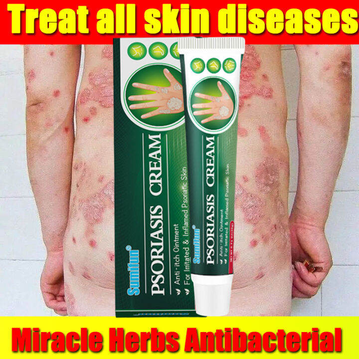 [COD]SUMIFUN ointment for itchy skin and allergy 20g For the treatment