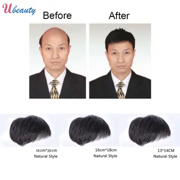 Update 150+ artificial hair for bald head best - ceg.edu.vn