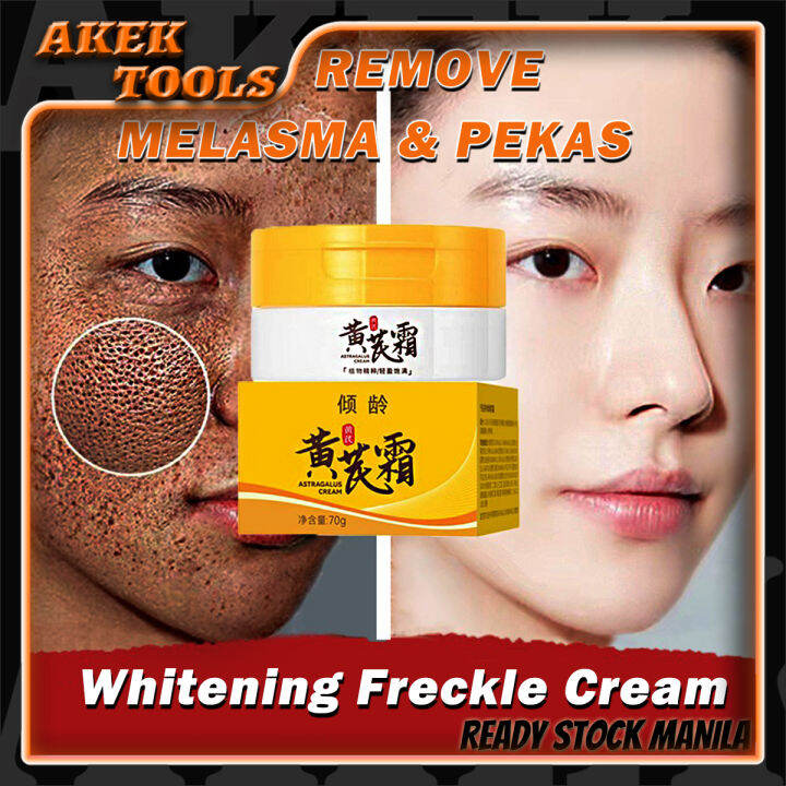 Original Melasma Remover Cream Astragalus Herbal Whitening Freckle