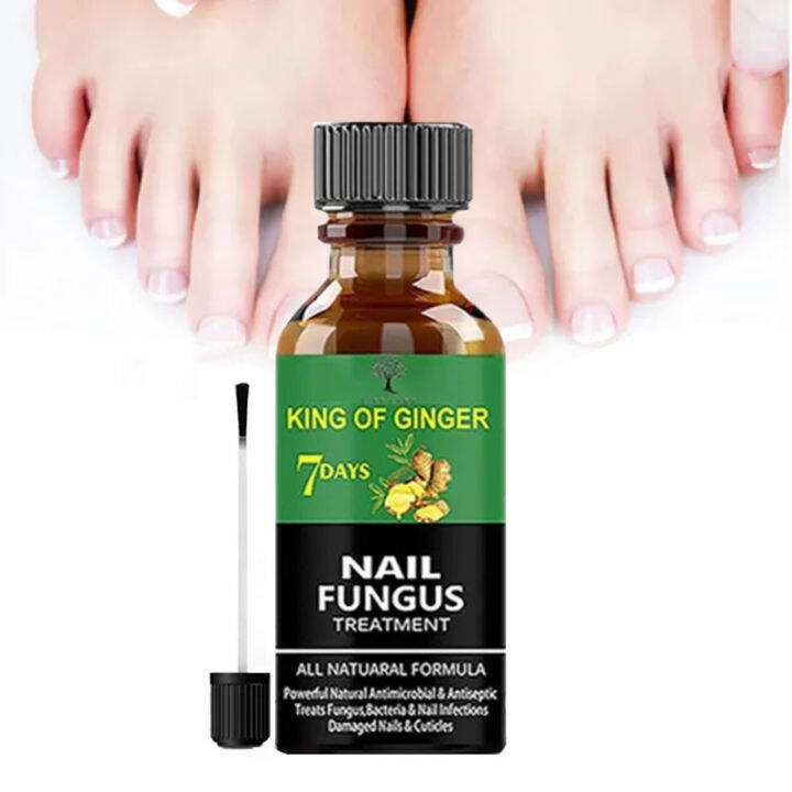 Nail fungal solution nail treatment solution foot anti-fungal essence ...