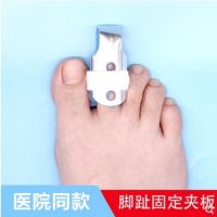 Toe Corrector Bow Upturn Curved Overlap Foot Hallux Valgus Day and Night