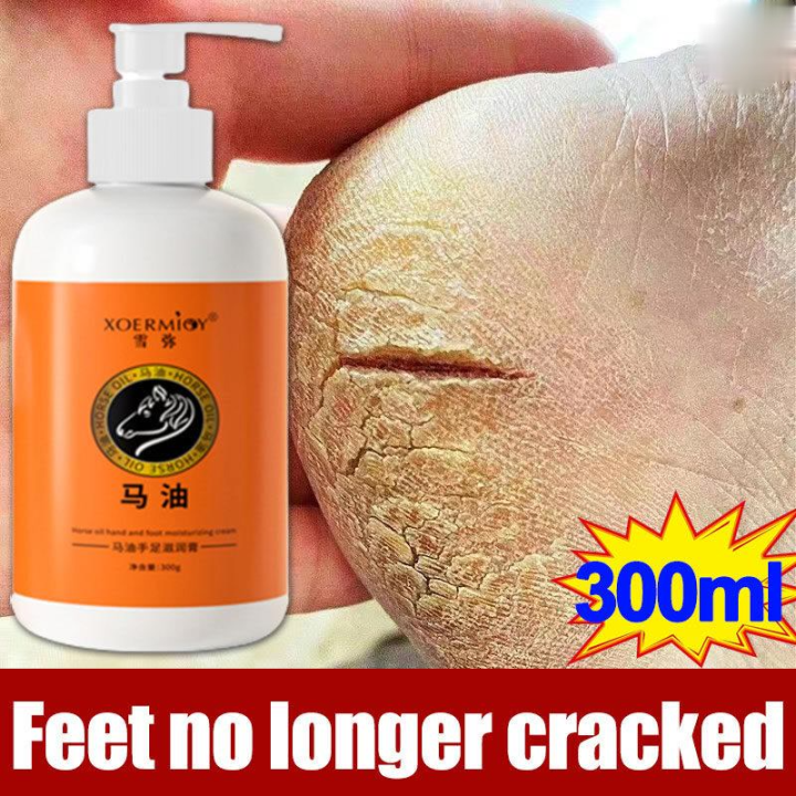 Large capacity 300ml horse oil Cracked heel cream Foot crack cream Krim ...