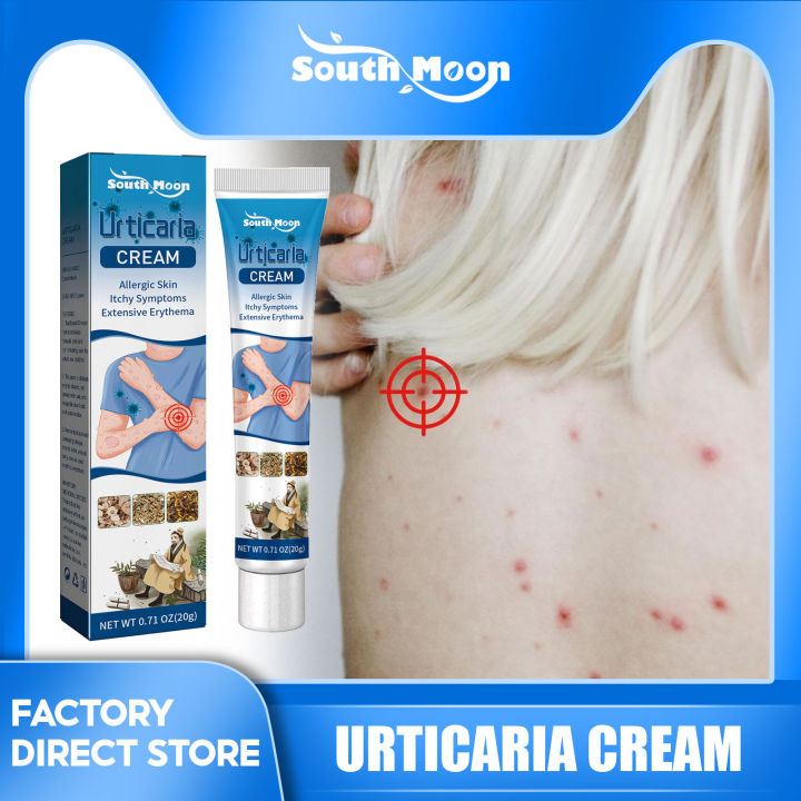 South Moon Urticaria Cream Psoriasis Antibacterial Cream Dermatitis ...