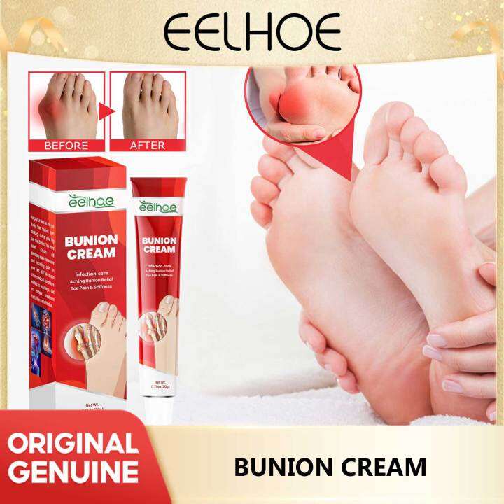 Eelhoe Bunion Pain Relief Cream Toe Finger Bone Spur Tendon Sheath ...