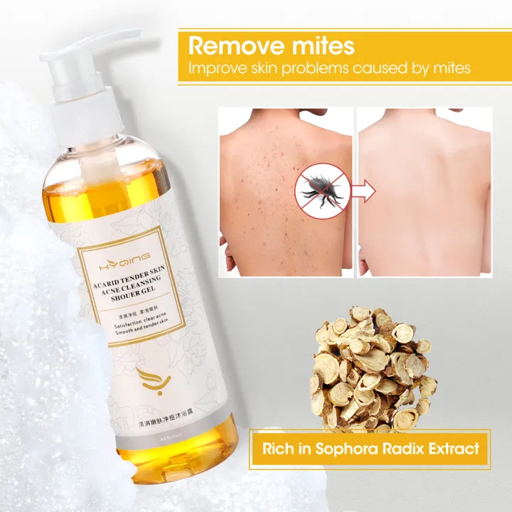 Antimite Shower Gel Acne Body Shower Sophora Flavescens Relieve Dry